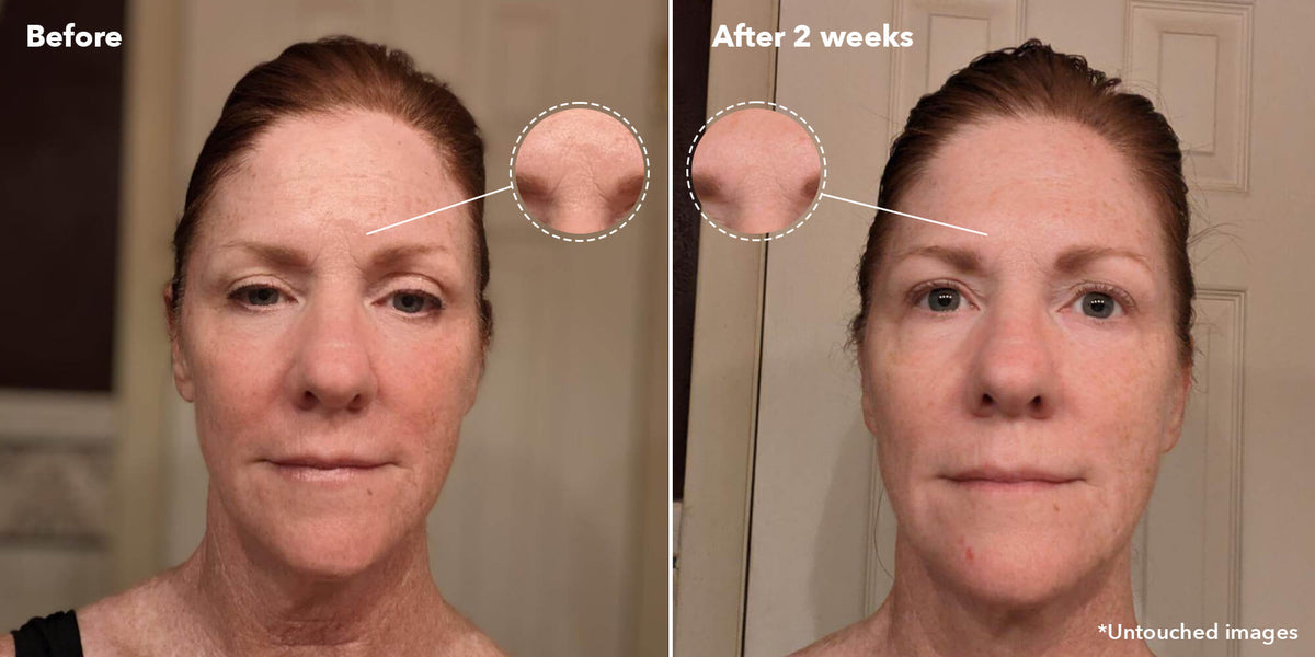 Before After - Kerala Rituals Ayurvedic Vitamin C Face Oil